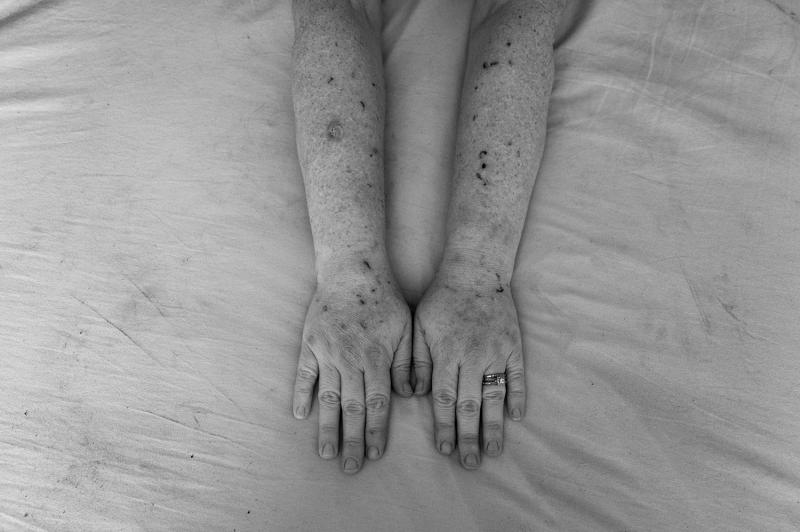 Two arms side-by-side.
