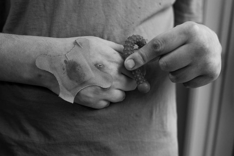 Hand covered in bandaid.